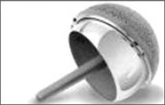 Joint Replacement Surgery Hospitals India